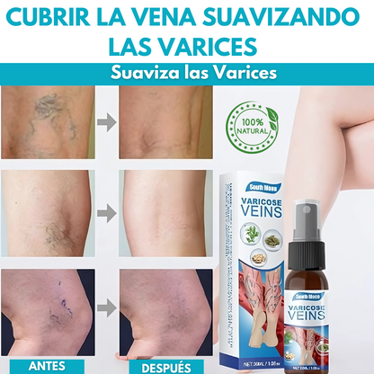 Spray Anti Varices Activefit®